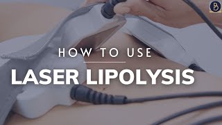 How to use Laser Lipolysis bodysculpting [upl. by Zeeba]