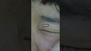 Dry Eye causes amp symptoms eyes eyecaretips eyecare [upl. by Sillig182]