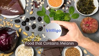 How to increase Melanin for Vitiligo l Vitiligo Food that Contains Melanin My Skin [upl. by Nafets800]