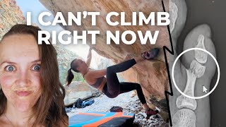 Rock climber recovers from a broken toe very painful [upl. by Eolcin]