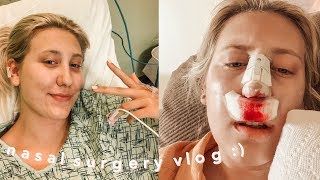 I GOT A SEPTOPLASTY RHINOPLASTY  TURBINATE REDUCTION [upl. by Pomeroy]