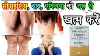 Beclomethasone Dipropionate 005 Lotion uses in hindi [upl. by Morvin]