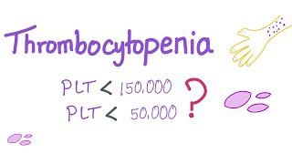 Thrombocytopenia  Why Is My Platelet Count Low [upl. by Rubi]