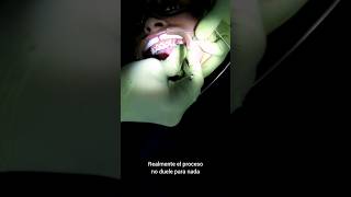 😬🦷BRACKETS ¿Cómo te los ponen 😬🦷😱 [upl. by Aryl137]