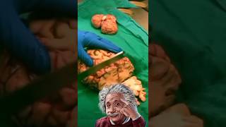 Why Albert Einstein Brain cut into 240 pieces [upl. by Jansen449]