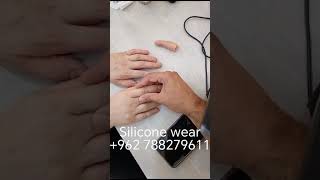 اصبع سبابة سيليكون silicone finger prosthesis [upl. by Jo Ann]