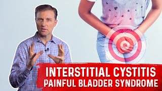 What is Interstitial Cystitis Painful Bladder Syndrome – Symptoms amp Remedy Covered by DrBerg [upl. by Maje309]