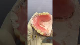 valplast flexibledenture dentallaboratory dentistry more info whatsapp 601133462064 [upl. by Shreve]