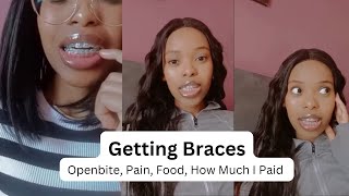 Getting Braces Vlog  Pain First Week Food How Much I Paid  South African YouTuber [upl. by Lancaster]