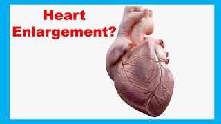 What Causes the Heart to Enlarge [upl. by Jacki]