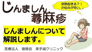 【形成外科・皮フ科】じんましん〜繰り返すじんましん、かゆみの対処法〜 [upl. by Nevaed636]