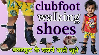 क्लब्फूट में चलने वाले जूते को कैसे पहनाएं । clubfoot walking shoes  ctev day time shoes [upl. by Josi]