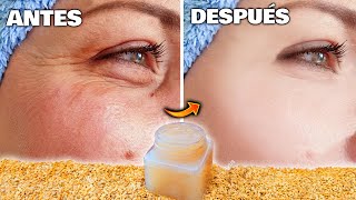 UN MILLÓN de VECES MÁS EFICAZ que el BOTOX  Elimina ARRUGAS y MARCAS de forma NATURAL y CASERA [upl. by Mayes339]