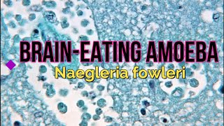 BrainEating Amoeba Naegleria fowleri [upl. by Nor514]