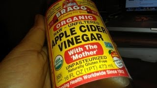 How To Pass a Kidney Stones Free and Naturally Treat Dissolve ACV health [upl. by Pomcroy81]