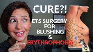 ETS SURGERY FOR BLUSHING Erythrophobia Cure A true ETS surgery experience amp story coming soon [upl. by Vaughn]