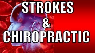 Half Hour to Health  Strokes Part 2 [upl. by Magdalene432]