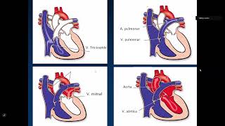 16 Cardiopatías Congénitas Cianóticas y Acianóticas [upl. by Lyrrehs]