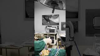 Laparoscopic Cholecystectomy  Gallbladder Removal Surgery [upl. by Eward]