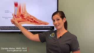 Treating Heel Bursitis and Achilles Tendinopathy with PRP Prolotherapy [upl. by Cazzie149]