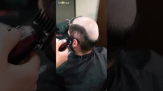 Protez Saç Merkezi SWell Hair hairreplacement protezsaç [upl. by Ailesor]