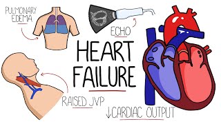 Heart Failure Explained  HFrEF vs HFpEF Systolic vs Diastolic Heart Failure [upl. by Shaer]