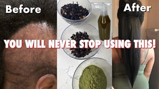 do not USE this hair treatment if you’re not ready for Extreme HAIR growth [upl. by Anirba]