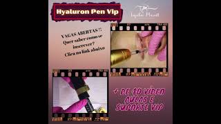 Vagas abertas para o Curso Hyaluron Pen Vip [upl. by Poppas]