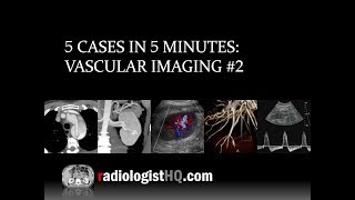 5 Cases in 5 Minutes Vascular 2 [upl. by Laina]