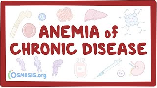 Anemia of chronic disease  an Osmosis Preview [upl. by Jereme]