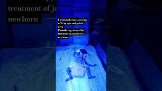 Phototherapy in jaundice✨youtube nursing hospitalequipment motivation nurshing doctorstatus [upl. by Sonnie277]