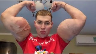 Bodybuilder aus Russland  from Synthol with love [upl. by Aljan301]