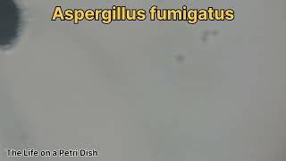 Aspergillus niger fumigatus and flavus [upl. by Atekahs]