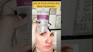 Best Facewash For Oily ampAcne prone skin Rejuglow Facewash 😱skincare oilyskin simranskincare [upl. by Anaig]