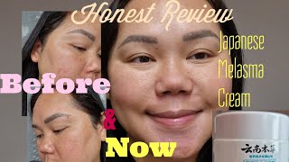 Japanese Melasma CreamMy Honest Review 1 Bottle used🙂😀😃 [upl. by Daphie]