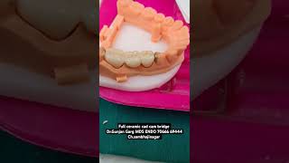 Fullceramicbridge zirconia bridgedrgunjangarg zirconiacapinaurangabad cadcamcap dentist [upl. by Aicen956]