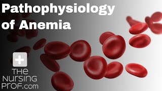 Pathophysiology of Anemia [upl. by Ecnahoy]