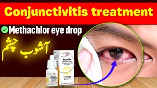 Methachlor eye drops  treatment of conjunctivitis [upl. by Roseann]