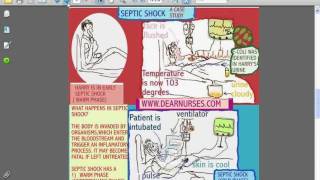 SESSIONS for NURSES 10  CARDIOGENIC AND SEPTIC SHOCK [upl. by Cathy]