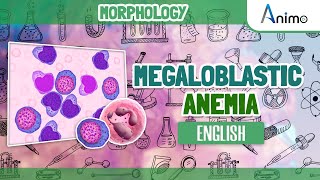 Megaloblastic Anemia  Histo pathology  RBC Morphology  English [upl. by Adniral]