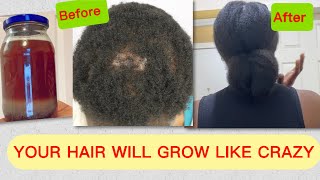 Don’t wash it out I’m still shocked  your hair will never stop growing 🔥naturalhairgrowth diy [upl. by Howell]