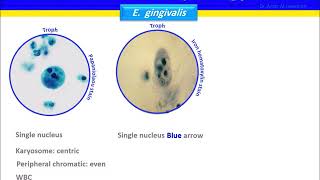 Entamoeba gingivalis [upl. by Lunseth]