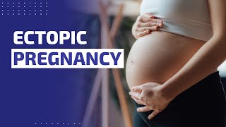 ECTOPIC PREGNANCY  OVERVIEW PATHOPHYSIOLOGY SIGNS AND SYMPTOMS TREATMENT INVESTIGATIONS [upl. by Pierro238]