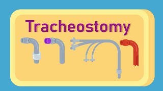 What is Tracheostomy [upl. by Aiyn]