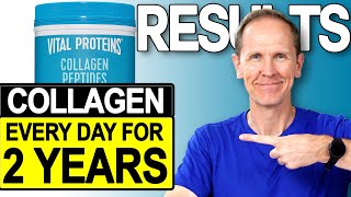 Vital Proteins Collagen Peptides  Results After 2 Years [upl. by Budge]