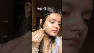 Say bye bye to ACNE amp ACNE marks Forever with this ONE product 😍🤌🏻 omg impressed😳 ytshorts [upl. by Araem]