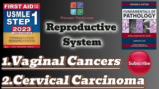 Usmle step 1Vaginal tumorsCervical carcinoma from PathomaReproductive system pathologyUrduHindi [upl. by Strenta]