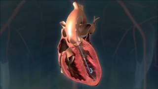 Impella® Heart Pump Animation For Patients [upl. by Puto]