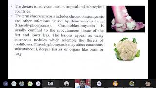 Chromomycosis Sporotrichosis [upl. by Landon453]