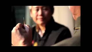 Acupuncture and moxibustion of traditional Chinese medicine [upl. by Nafri]